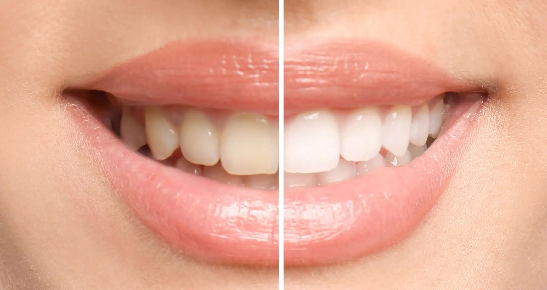A confident, healthy smile after consistent dental care