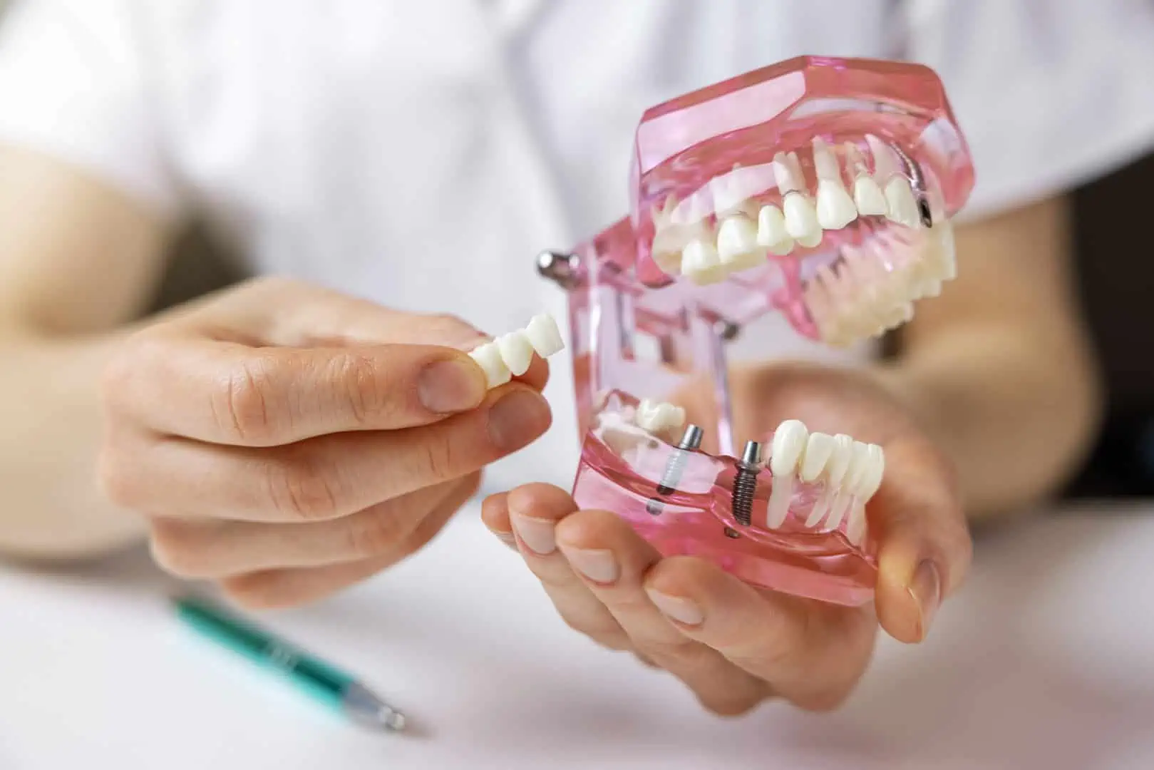 A complete smile restored after years of working around a missing tooth